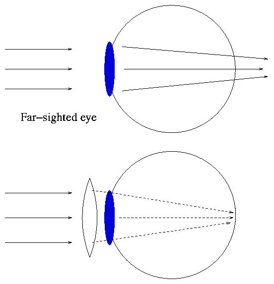 Re: Does different prescriptions of eye glasses affect light passing ...